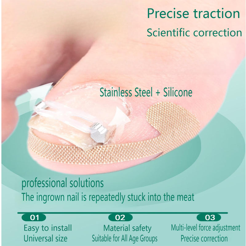 Ingrown Toenail Corrector Kit for Men Women - Ingrown Nail Tool - 2 Stainless Steel Clips- Curved Nail Strips & Toe Pads for Embedded/Curled Nails