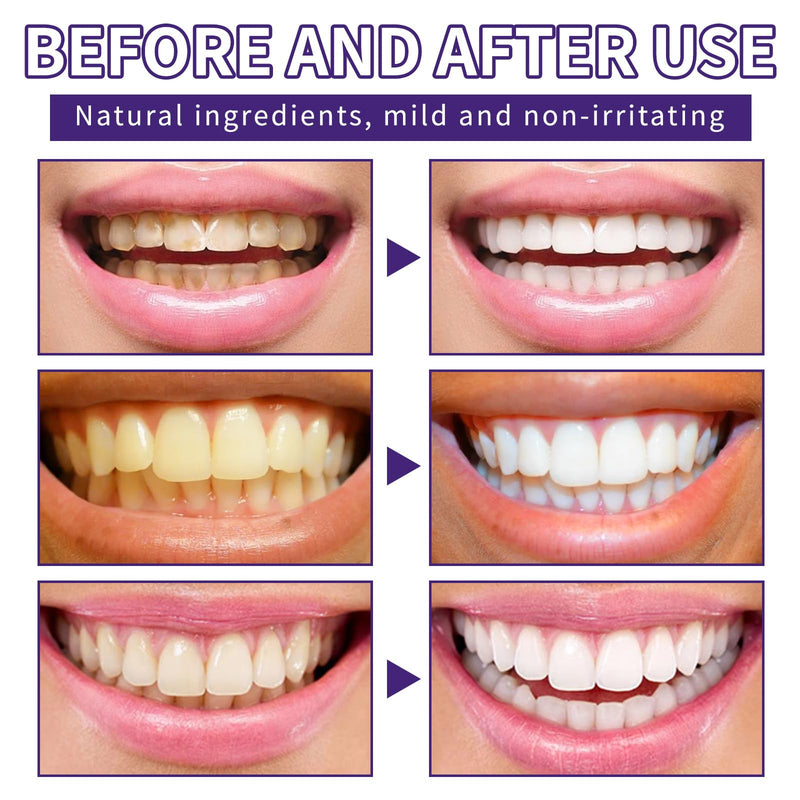 Teeth Restoration Mineral Powder - Restoration Mineral Tooth Powder Toothpaste, in Strengthening Teeth and Gums, Protect Gums and Freshen Breath, for Coffee, Tea and Tobacco Stains-50g 1.76 Ounce (Pack of 1)