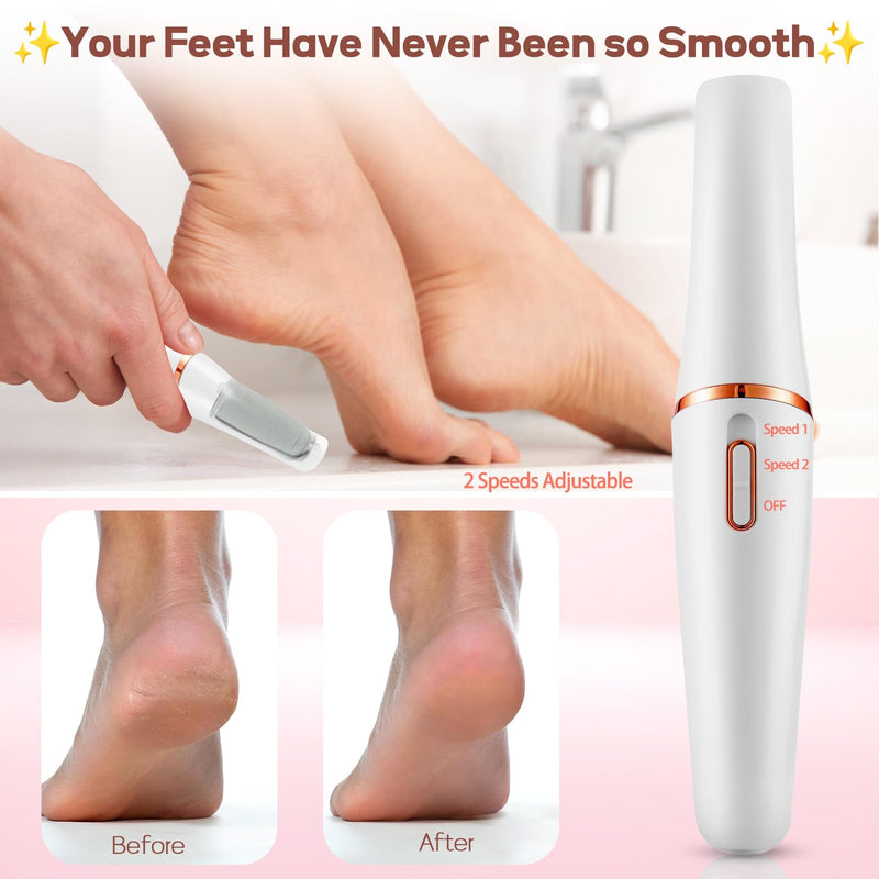 Electric Foot Callus Remover, ZABOUL Electric Foot File Callus Remover Rechargeable Portable Pedicure Tool Kit, Smooth Pedicure Wand for Feet Care, Removes Dry Hard & Dead Skin Ideal Gift (White) White - BeesActive Australia
