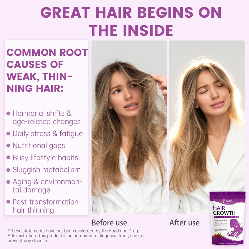 Hair Growth Vitamins Gummies for Women and Men, Biotin Soft Chews for Thicker Fuller Stronger Hair Growth, Hair Supplement Accelerator, Mixed Berry Flavor, 60 Soft Chews (Cherry) Cherry
