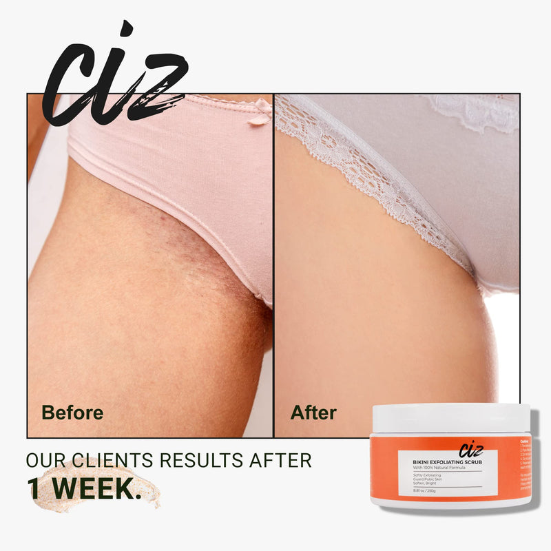 Bikini Area Exfoliator, Exfoliating Scrub for Bikini Area, Ingrown Hair Treatment for Bikini Area, Razor Bump Treatment for Bikini Area, Sugar Scrub for Bikini Area, Shaving Exfoliator Scrub for Women - BeesActive Australia