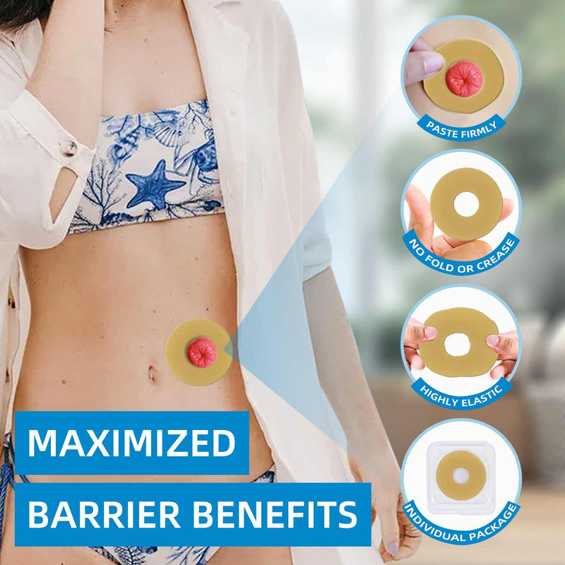 10PCS Ostomy Barrier Rings,Sting Free Moldable Ostomy Rings,Hydrocolloid Skin Extender Rings for colostomy Bags 2MM - BeesActive Australia