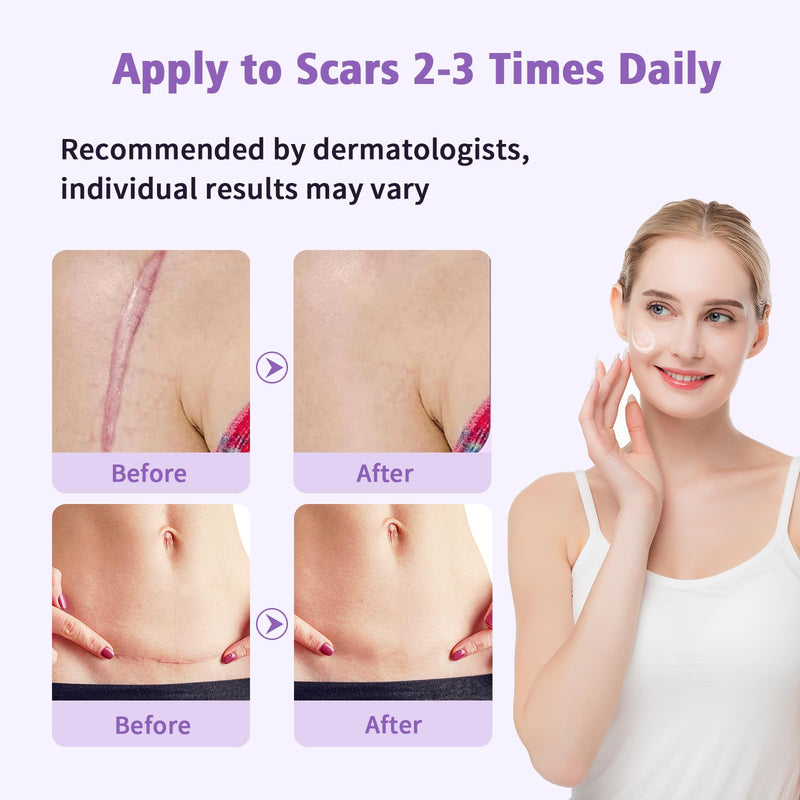 Medical Grade Silicone Scar Gel - Advanced Scar Removal Cream & Scar Treatment for Surgical, C-Section, Hypertrophic & Acne Scars - 1.7oz 1.7 Ounce - BeesActive Australia