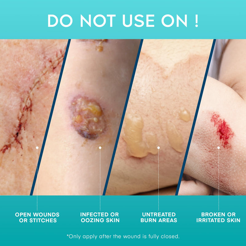 Aroamas Scar Advanced Scar Gel - Medical-Grade Silicone Scar Gel to Help Improve The Appearance of Scars and Stretch Marks for Face & Body - 45g - BeesActive Australia