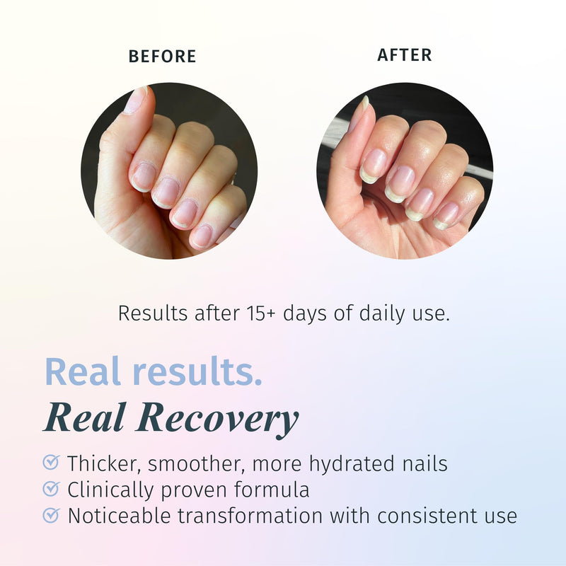 Duri Rejuvacote 1 Original Maximum Strength Nail Growth System Base and Top Coat - Nail Hardener Repair Chipping Strengthen Breaking and Brittle Treatment, by Duri Cosmetics (Pack of 1) Clear 0.45 Fl Oz (Pack of 1)