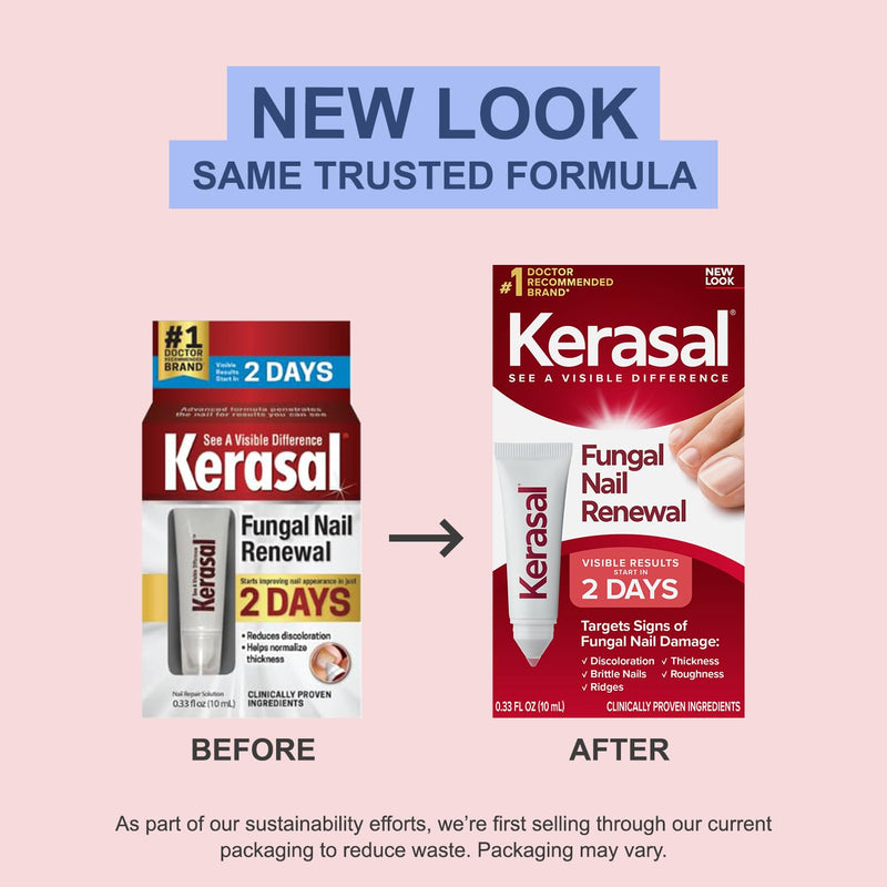 Kerasal Nail Fungus Extra Strength | Restorative Nail Repair for Damaged Nails, 0.33 fl oz (Packaging May Vary) Nail Renewal 0.33 Fl Oz (Pack of 1)