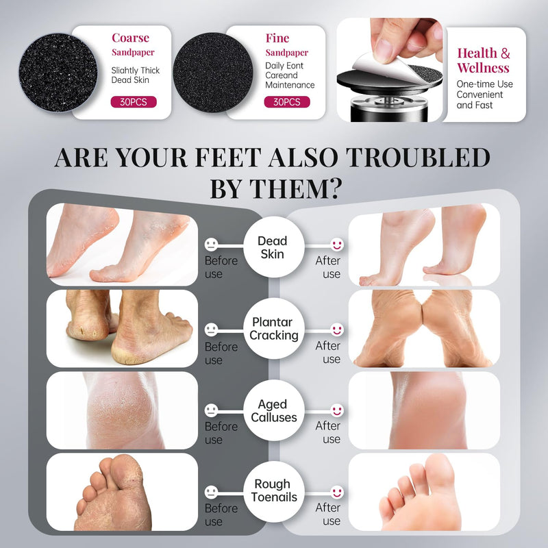 krofaue 1000RPM Electric Callus Remover - Professional Aluminum Foot File Adjustable Pedicure Tool with 60pcs Sandpaper Discs for Dead Skin at Home Black 1000r/Min Foot File 1 Count (Pack of 1) - BeesActive Australia