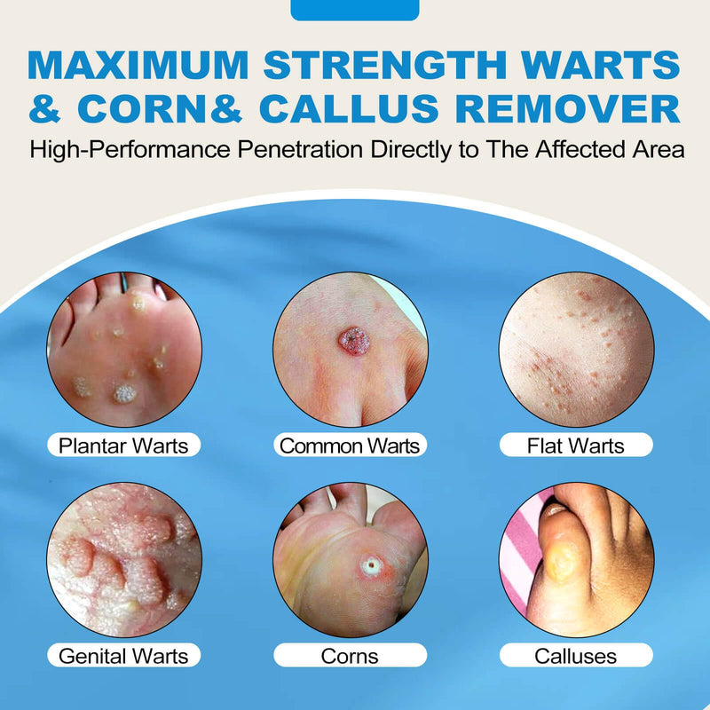 Fast Action Liquid Wart Gel Maximum Strength - Wart Liquid with Salicylic Acid - Fast-Acting Wart Liquid Freeze Off Designed for Warts, Plantar Wart, Genital Wart, Common Wart, Flat Wart, Corn, Callus Clear - BeesActive Australia