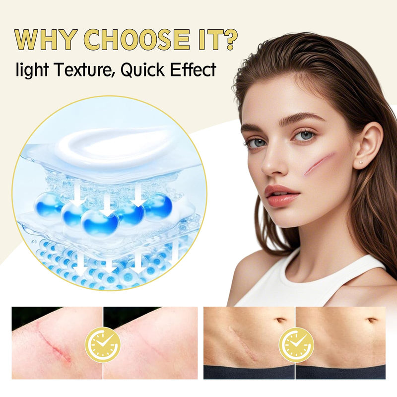 Advanced Scar Cream, Silicone Gel for Scars, Professional Scar Removal Cream for Surgical Scars, Stretch Marks, Old and New Scars, Keloids, Acne, Burns, 2 oz(60ml)