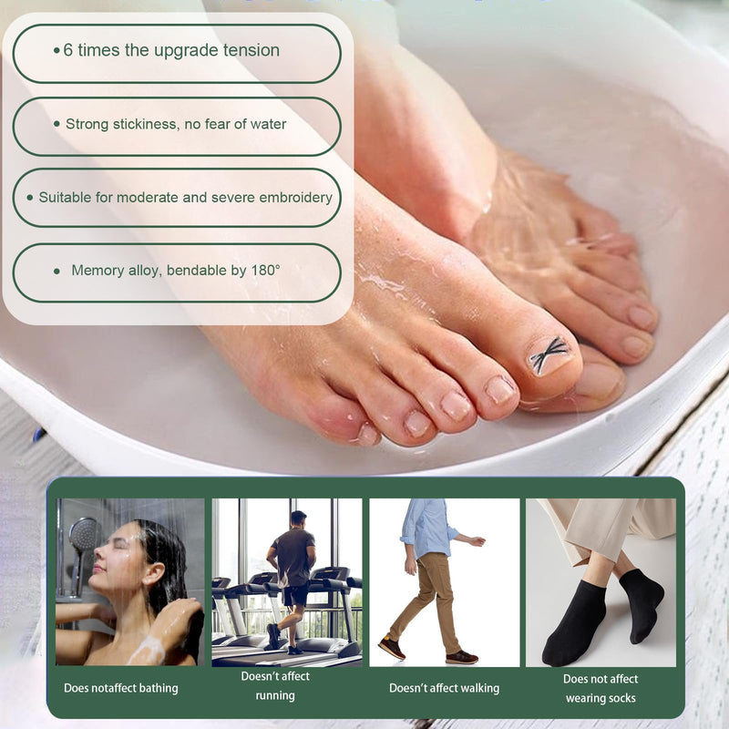 Titanium Alloy Ingrown Toenail Treatment 3X Stronger Pulling Force, Nail Tools and Ingrown Toenail Repair Kit for Curved & Thick Nails, Professional Foot Care Solution for Men & Women (0.63/0.67 in) 0.63-0.67in - BeesActive Australia