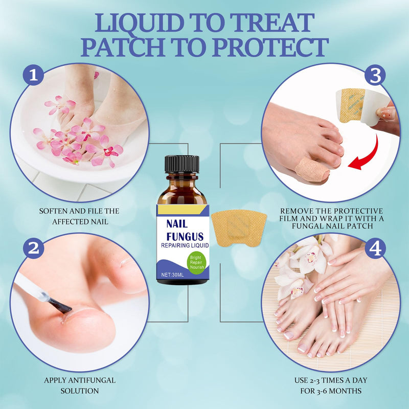Toenail Fungus Treatment Extra Strength Kit, 30ml Nail Repair Solution and 32 Nail Renewal Patches for Damaged Thick Discolored Toenails and Fingernail