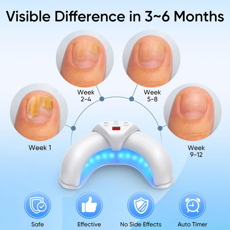 Home Toenail Repair Treatment for Multiple Toenails & Fingernails, Three Modes 3/5/10Minutes Auto Off - BeesActive Australia