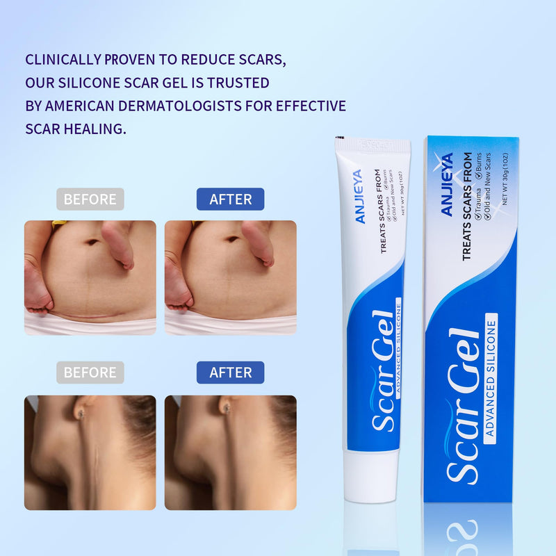 Silicone Scar Gel Advanced Scar Cream for Old & New Scars, Fades C-Section, Keloids, Stretch Marks, Burns, Surgeon Recommended Scar Repair A