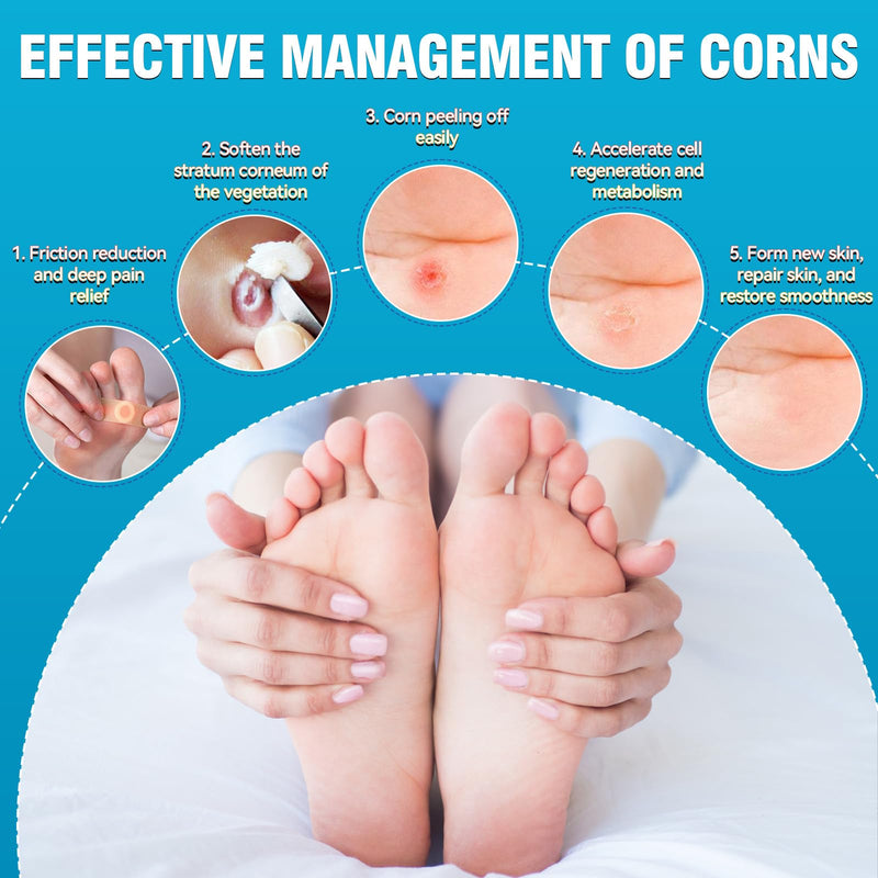 AstraVox 24Pcs Corn Removers for Toes Feet with Adhesive PU Waterproof Membrane, Plantar Corn Remover Bandaid Pads Kit for Hand, Highly Effective, Pain Relief, Easy to Use (Large) Large - BeesActive Australia