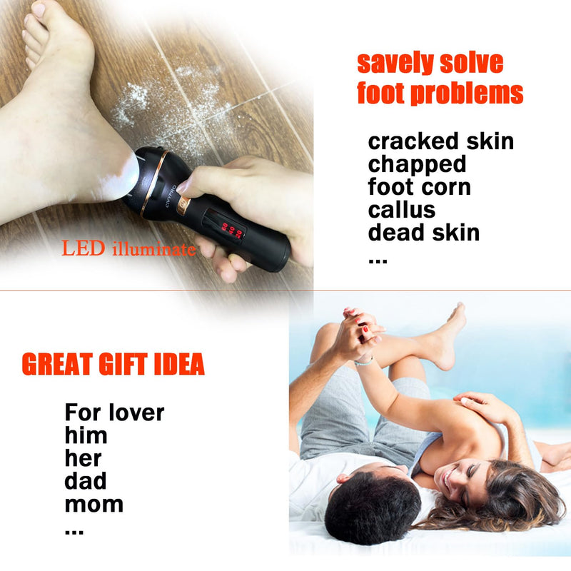 Electric Foot Callus Remover- Long Service Time, Rechargeable Electronic Foot File- Ideal Gift, Professional Pedicure Tools, Waterproof Foot Scrubber, Pedicure Kit Feet Care for Dead Skin (Black) Black - BeesActive Australia