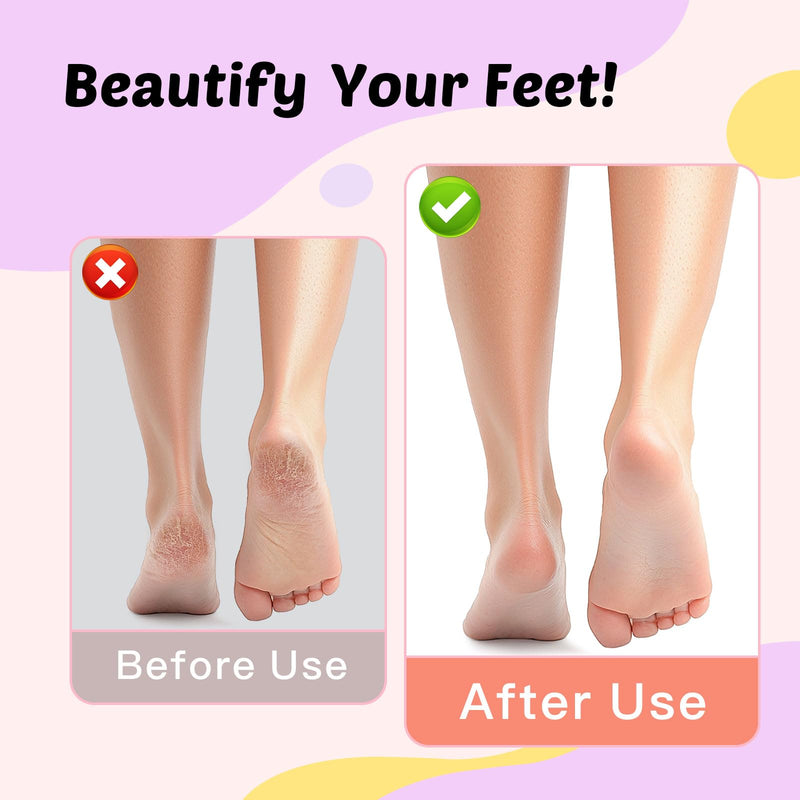 Electric Foot Callus Remover, 9-Speed for Dead Skin & Hard Calluses, Aluminum Alloy, Type-C Rechargeable, Replacement Discs, Spa-Like At-Home Pedicure, Relaxing Self-Care (Deep Lavender) Deep Lavender（basic Edition） - BeesActive Australia