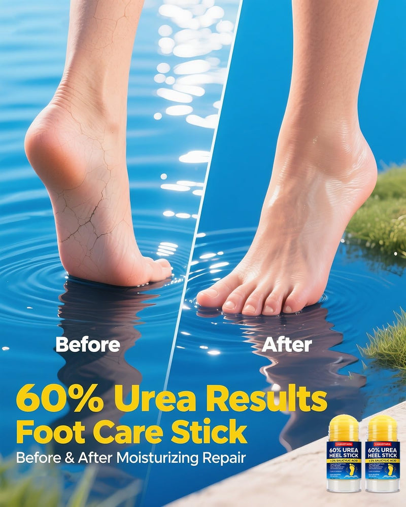 Urea Cream 60 Percent with 2% Salicylic Acid, Maximum Strength Foot Cream for Rough, Dry Cracked Feet Hands and Elbows, Urea Stick Callus Remover Skin Softener Hydrating Balm 2 Pack (1.41oz Each) 1.41 Ounce (Pack of 2)