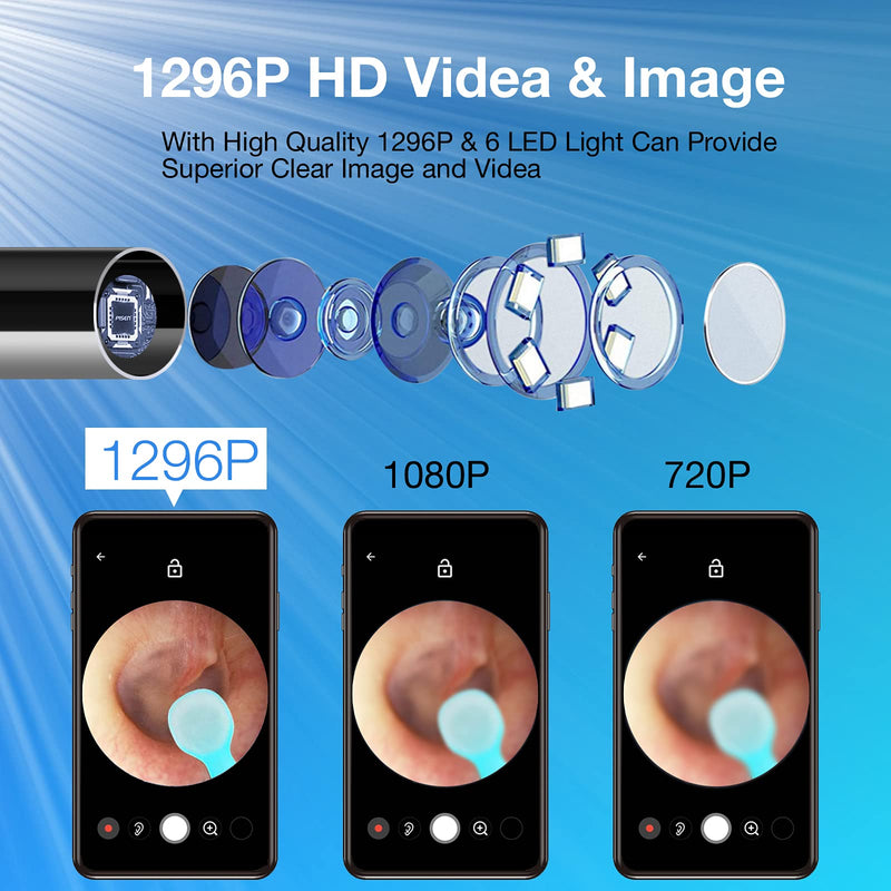 Ear Wax Removal with Camera, Earwax Remover Tool, 1296P FHD Wireless Ear Otoscope with 6 LED Lights, 6 Ear Spoon & 6 Traditional Tools Ear Wax Removal Kit for iPhone, iPad & Android Smart Phone - BeesActive Australia