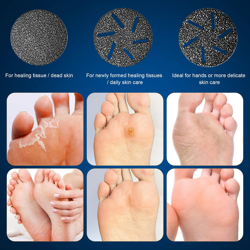 Electric Foot Callus Remover, IPX7 Waterproof Pedicure Kit Rechargeable Calloused Feet Remover Tool with LCD Display, 2-Speed Dual Motors for Efficient Exfoliation of Dead Skin on Feet - BeesActive Australia