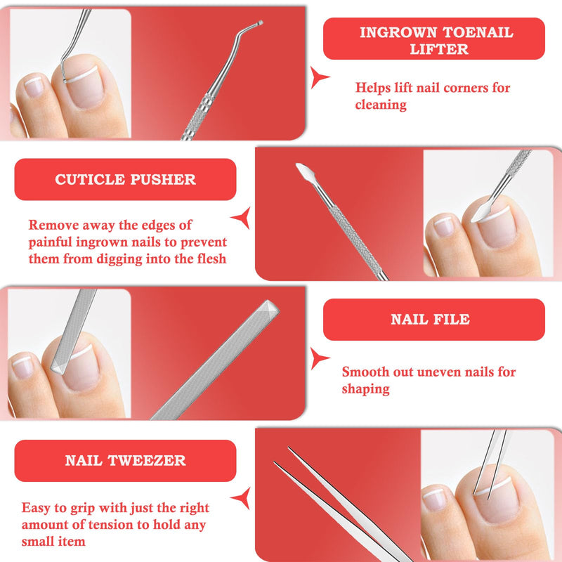 Ingrown Toenail Removal Kit, Professional Ingrown Toenail Treatment, Ingrown Toenail Tools Kit with Ingrown Toenail Corrector Drops, Toenail Clipper, Corrector Patch, Stainless Steel Pedicure Tool Set - BeesActive Australia