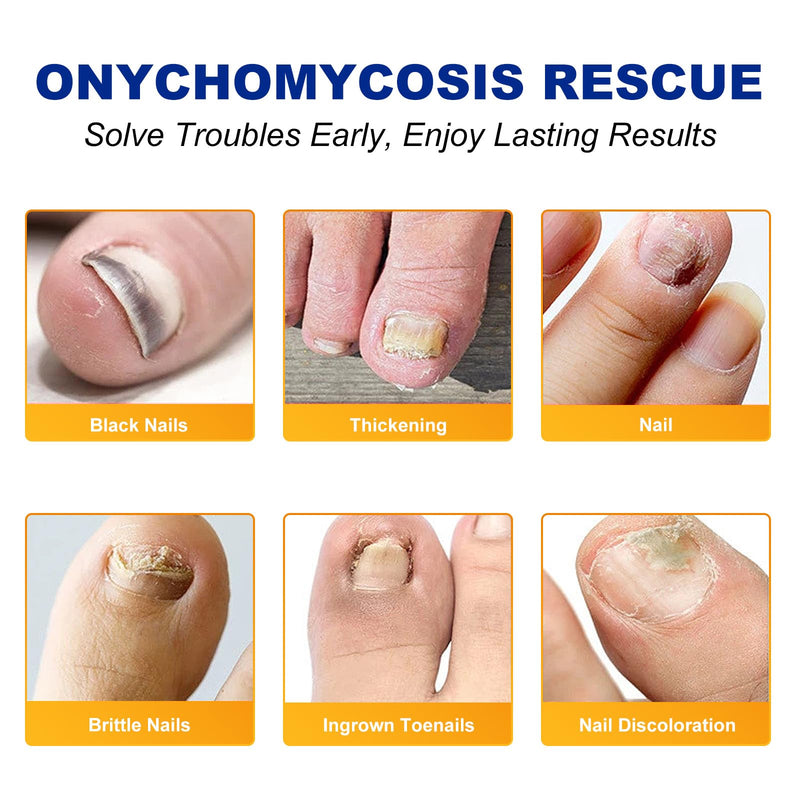 Toenail Treatment Extra Strength-8-Hrs Overnight Nail Repair,ingrown toenail treatment,Strengthens Brittle Nails,Improves Texture & Thickening Hypoallergenic Easy (64 Patch) 1 Count (Pack of 64)
