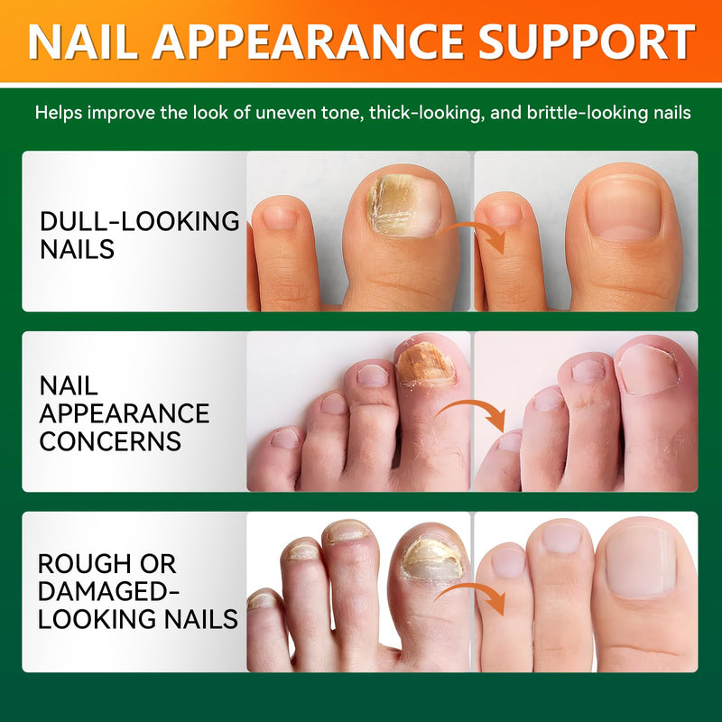 Toenail Fungus Treatment Extra Strength, Nail Repair Solution with Tea Tree Oil, Menthol, Vitamin E & Pro-Vitamin B5, Gentle Care for Damaged, Discolored, and Brittle Nails, 1 fl oz - BeesActive Australia