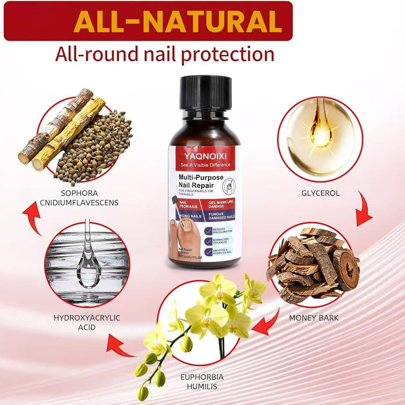 Toenail Fungus Treatment - Fast Acting For Thick, Discolored, Broken & Damaged Toe & Finger Nail, Treats Damaged Nails and Ingrown Toenails - 30ml/1oz (1pcs) 1pcs
