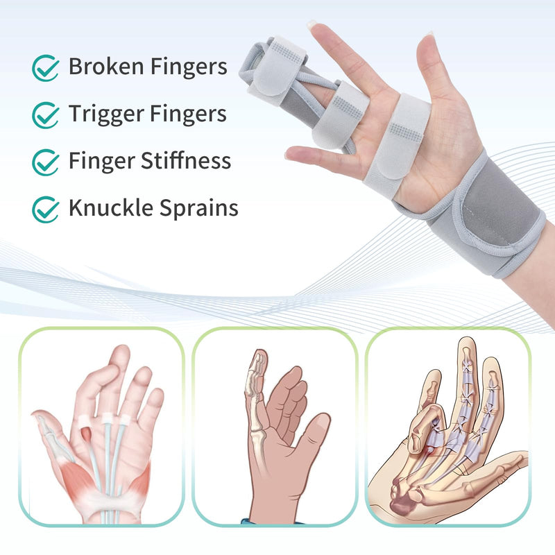 Trigger Finger Splint, Finger Brace for Middle, Index, Pinky, or Ring Finger Support, Hand Splint for Arthritis, Fracture, Hand Brace Splint with maniphalanx Support (2 Fingers Fixed) -Upgrade Fabric Gray