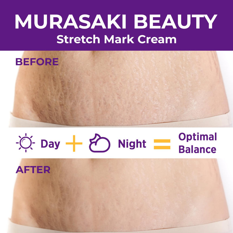 Stretch Mark Cream Prevention for Pregnancy - Maternity Cream for Stretch Marks Removal | Nourishing Formula – Prevents Stretch Marks & Improves Elasticity - 4 oz (120g) (4 oz (120g)) 4 Ounce (120g)