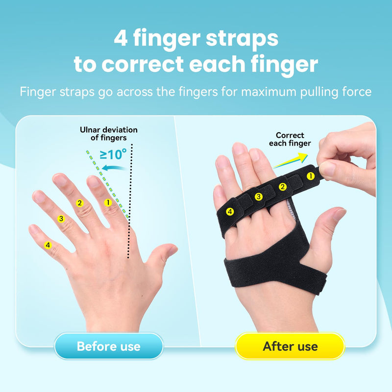 DrFinger Finger Ulnar Deviation Splint Brace, Finger Joint Deviation Orthopedic Corrector With Metal Bracket-Black-(Left-M) Black Left-M