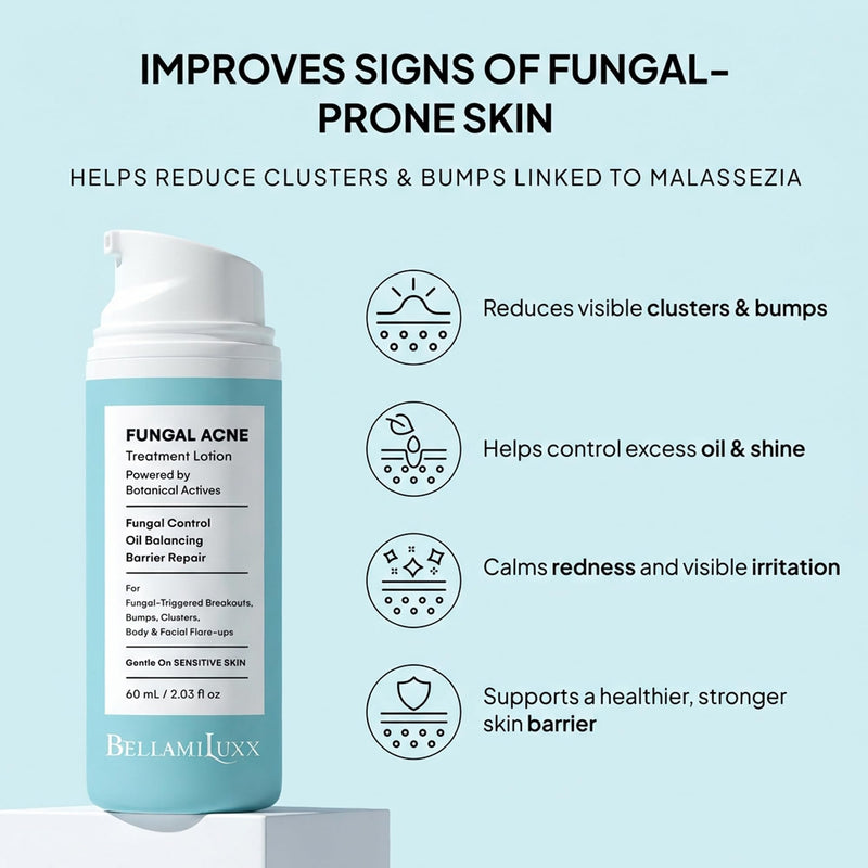 BellamiLuxx Fungal Acne Treatment Lotion: Effective Face & Body Pimple Cream for Bumps, Clusters, Itch & Redness – Fungal Prone Skin Acne Treatment Moisturizer for Teens & Adults with Natural Actives 1-Bottle - BeesActive Australia
