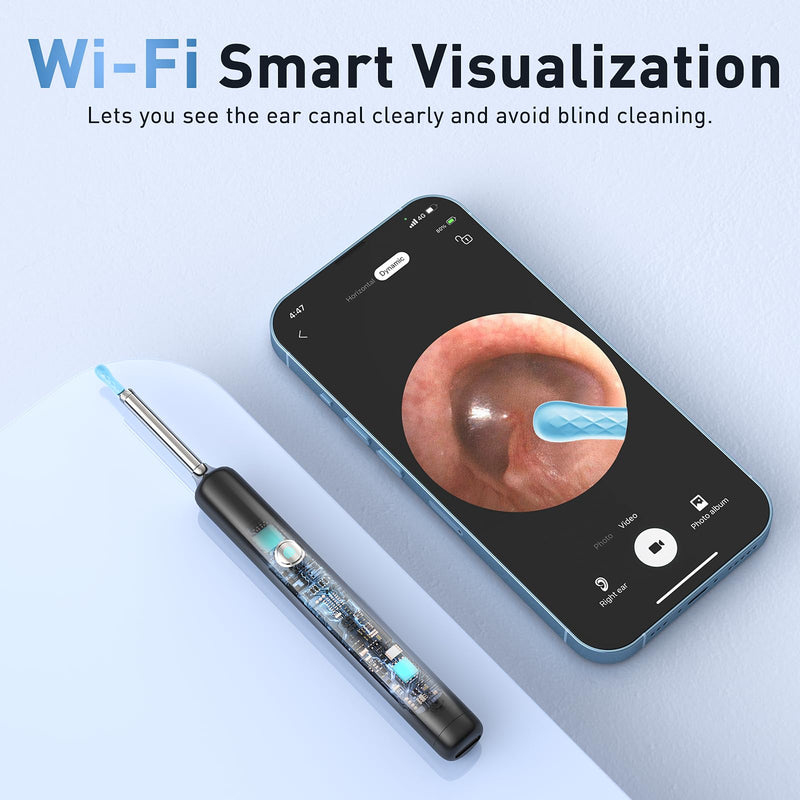 Ear Wax Removal - Electric Ear Irrigation Flushing System with 4 Pressure Modes, Ear Cleaner with Camera, 1080P Otoscope, Ear Cleaning Tool with 7 Pcs Ear Set, Safe and Effective Earwax Removal Kit Black