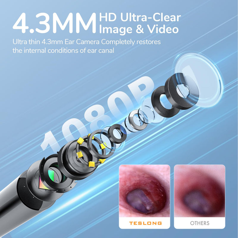 Teslong Digital Otoscope with Light, 1080p HD Ear Camera with Ear Wax Removal Tools, Video Ear Scope Otoscope with Light, Compatible with iPhone15, iPad, Android Phone, USB, Ear Picks, Waterproof - BeesActive Australia