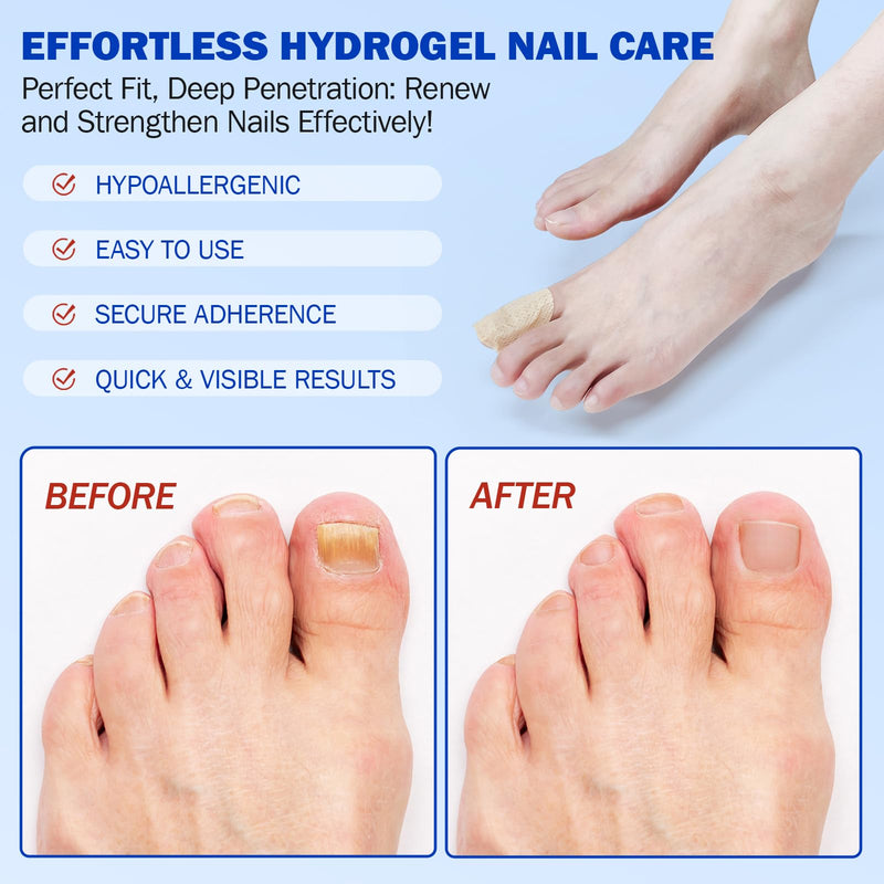 Fungal Nail Patches for Toenails (42 pcs), Fungal Nail Patches Extra Strength, Nighttime Repair Pads for Weak and Damaged Nails, Restore Discoloration and Thickness, Easy To Use