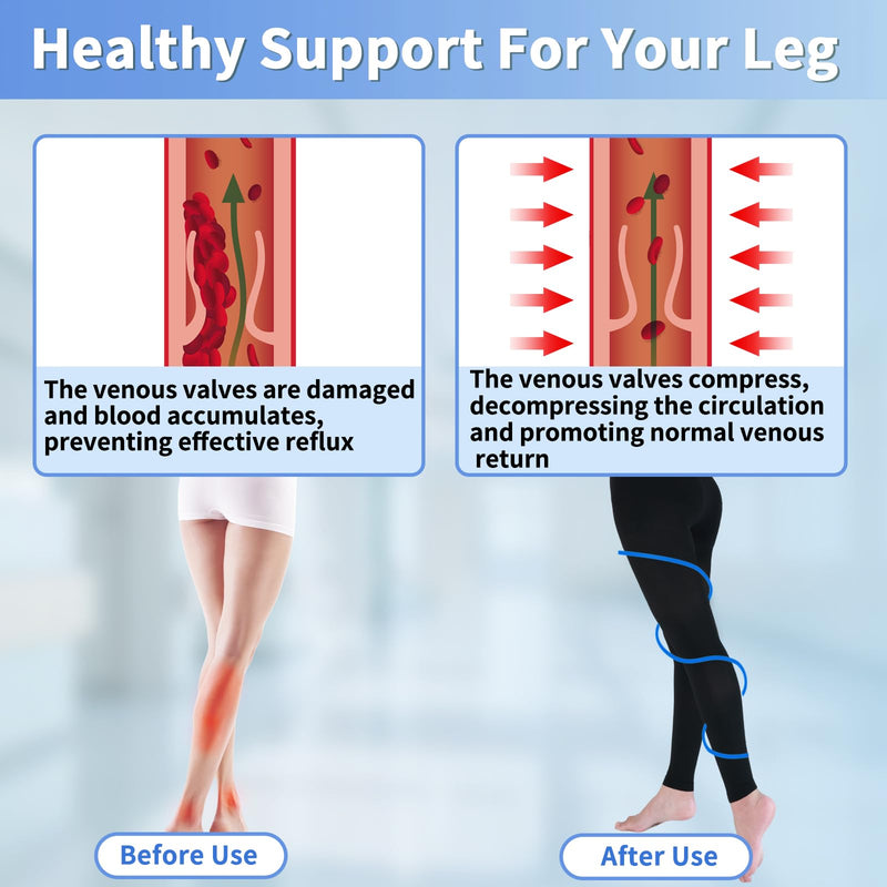 Medical Compression Pantyhose for Women & Men, 20-30mmHg Graduated Support Compression Tights Footless Medical Compression Stockings & Leggings for Edema, Varicose Veins, Swelling(Black,L) Large Footless/Black