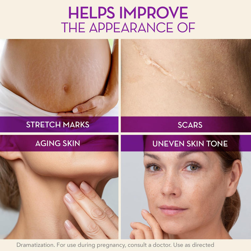 Cicatricure Cica Oil for Stretch Marks & Scars, Visible Results in 4 Weeks, Pregnancy Must-Haves Body Oil with Vitamin E, Stretch Mark Oil, Scar Treatment with Botanical Ingredients, 6.7 fl oz 6.7 Fl Oz (PACK OF 1) - BeesActive Australia