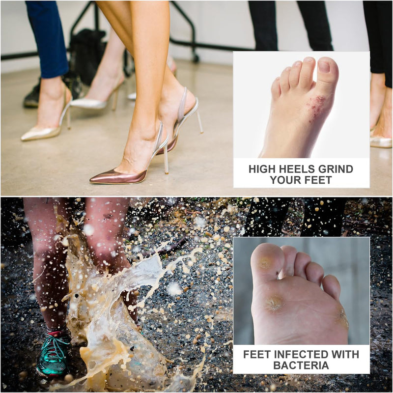 12 Sheets 108PCS Self Adhesive Callus Cushions Soft Foam Corn Pads Toe and Foot Protectors corn pads for toes,callus pads - BeesActive Australia