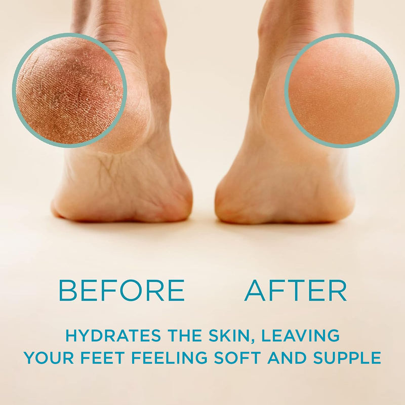 Lee Beauty 8oz Professional Gel Callus Remover for Feet - Original Fast-Acting Formula, Extra Strength for Cracked Heels & Dead Skin (Pack of 2) 8 Ounce (Pack of 2) - BeesActive Australia