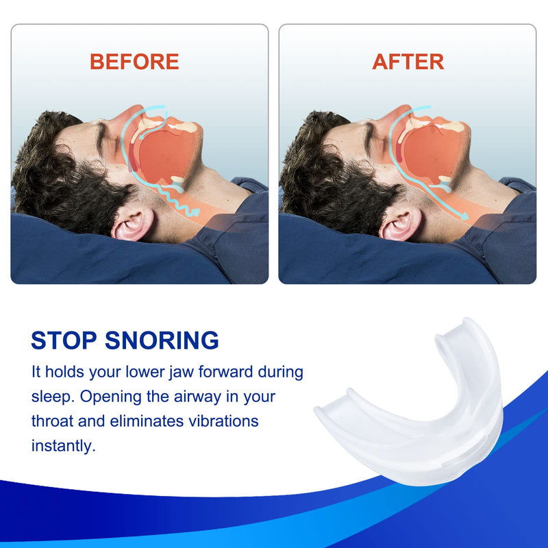 Anti-Snore Device, Anti-Snoring Mouth Guard, Snoring Solution Mouthpiece for Men and Women-J05 Clear L