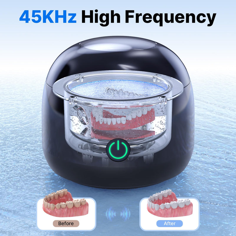 CXRUY Ultrasonic Retainer Cleaner - UV Dental Cleaning Pod Night Guard Cleaner for Dentures, Aligner, Braces, Toothbrush Heads, Jewelry (Black) Black - BeesActive Australia