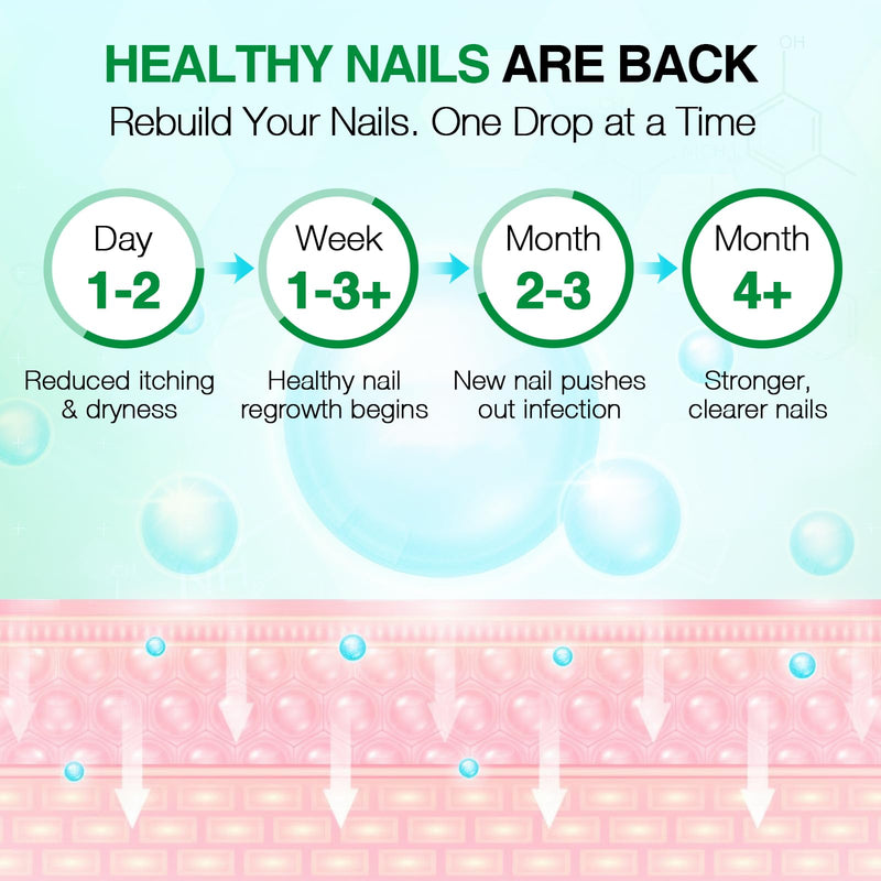 Toenail Fungus Treatment, 25% Undecylenic Acid Nail Repair Liquid 30ML & Clarus Tolnaftate 1% Toenail Fungus Cream 30g Set for Yellow toenails, Damaged Nail treatment extra strength with Tea Tree Oil 1 Fl Oz (Pack of 1)