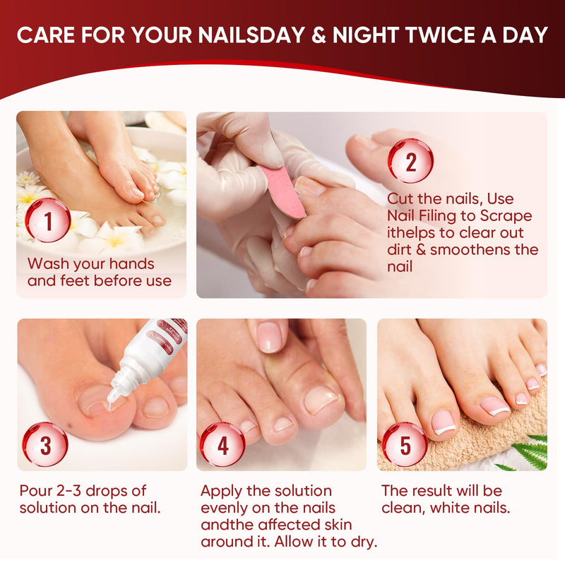 Toenail Treatment,Gentle Formula, Effectively Improves Nails for a More Beautiful Appearance 0.5 Fl Oz (Pack of 2) - BeesActive Australia