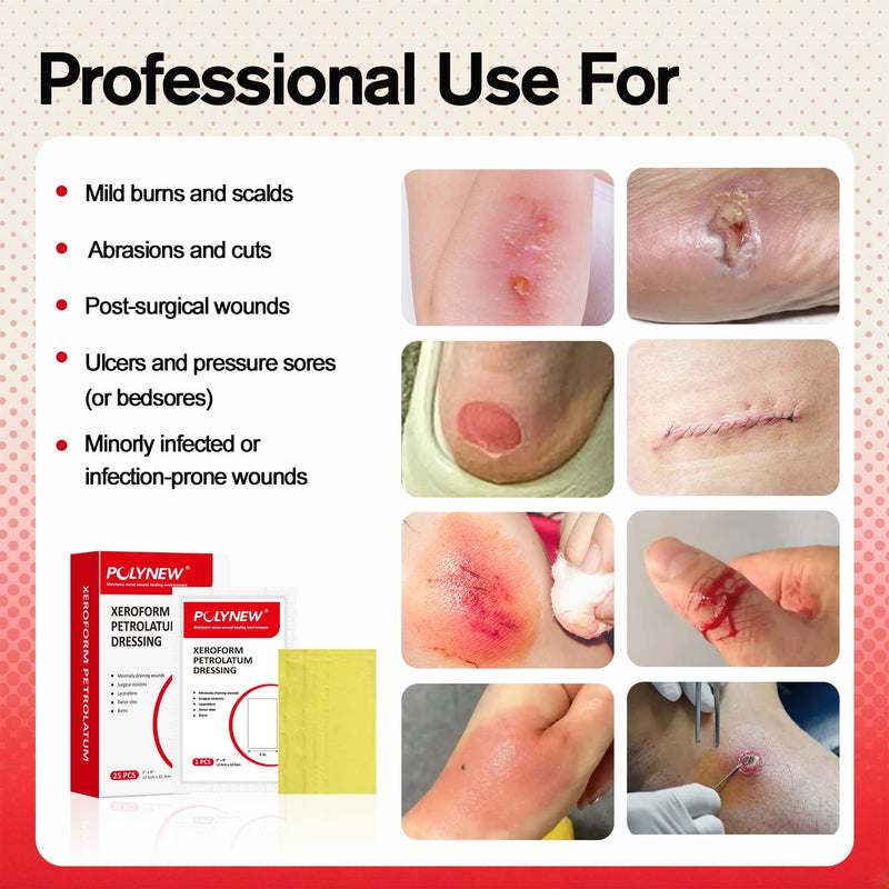 Xeroform Petrolatum Dressing 5"x9", 25 PCS Non-Adherent Gauze for Low Exudating Wounds, Fine Mesh Gauze Pads for Burns, Abrasions, Lacerations, Skin Grafts and Surgical Incisions 5" x 9" (Pack of 25)
