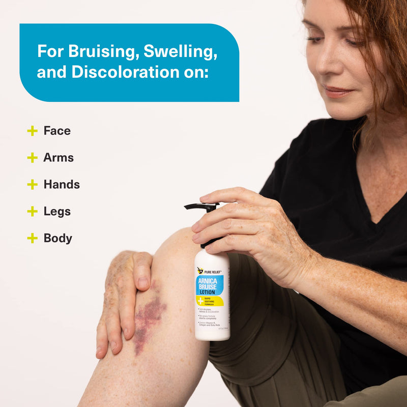 Pure Relief Arnica Cream Bruise Relief Lotion For Bruising | Arnica Montana Extra Strength Vitamin K Cream | Moisturizing Formula Skin Care Gel With Horse Chestnut & Collagen, 4 Fl Oz, 3PC 4 Fl Oz (Pack of 3)