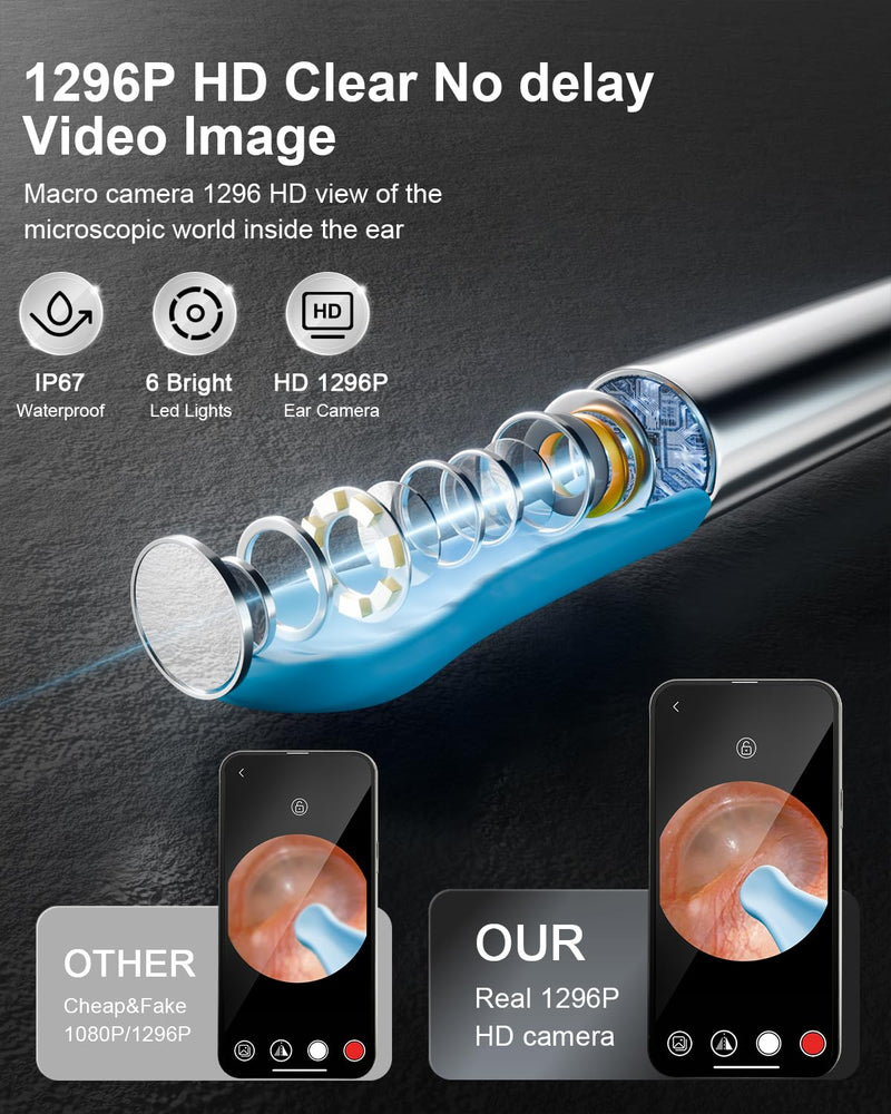 NEATEST Ear Wax Removal Tool with Camera - Ear Cleaner with 1296P HD Otoscope 6 LED Lights 8 Different Earwax Removal Kit Wireless Visual Ear Cleaning Tool for iPhone & Android Phones Jet Black - BeesActive Australia