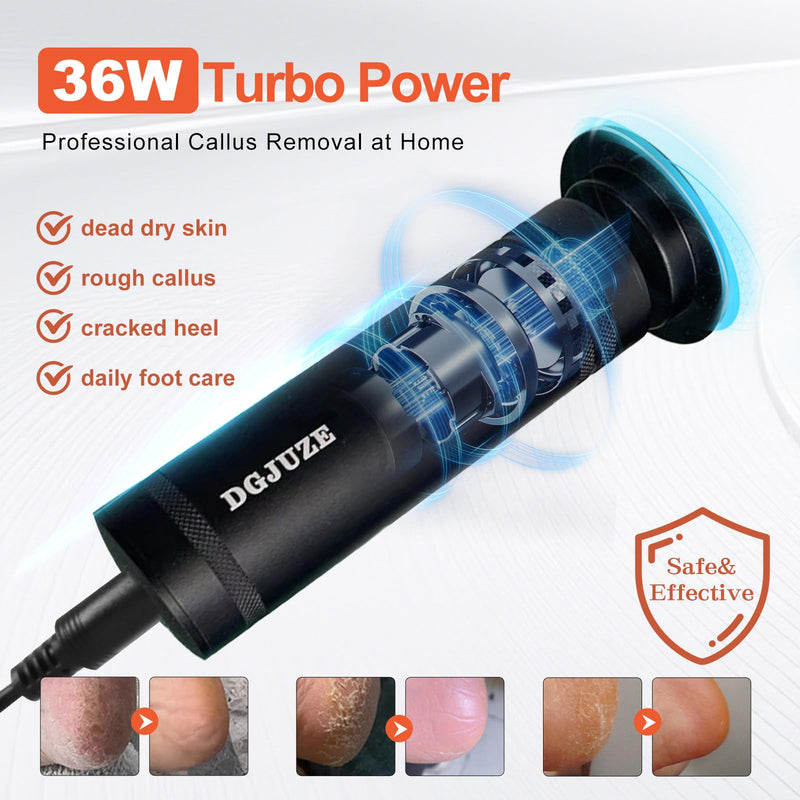 PowerPro Electric Foot Callus Remover,36W Professional 1200rpm Heavy Duty Metal Grinder for Dead Skin Automatic Foot Sander with 60pcs Sandpaper Pads for Home Use Pedicure Kit(Black) Black - BeesActive Australia