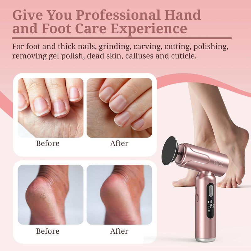 PELCAS Electric Foot Callus Remover with LED Screen, 2 in 1 Manicure & Pedicure Kit, 100 PCS Sandpapers Electric Foot File for Women & Men, Cordless Feet Filer for Foot Callus, Thick Nails Pink - BeesActive Australia