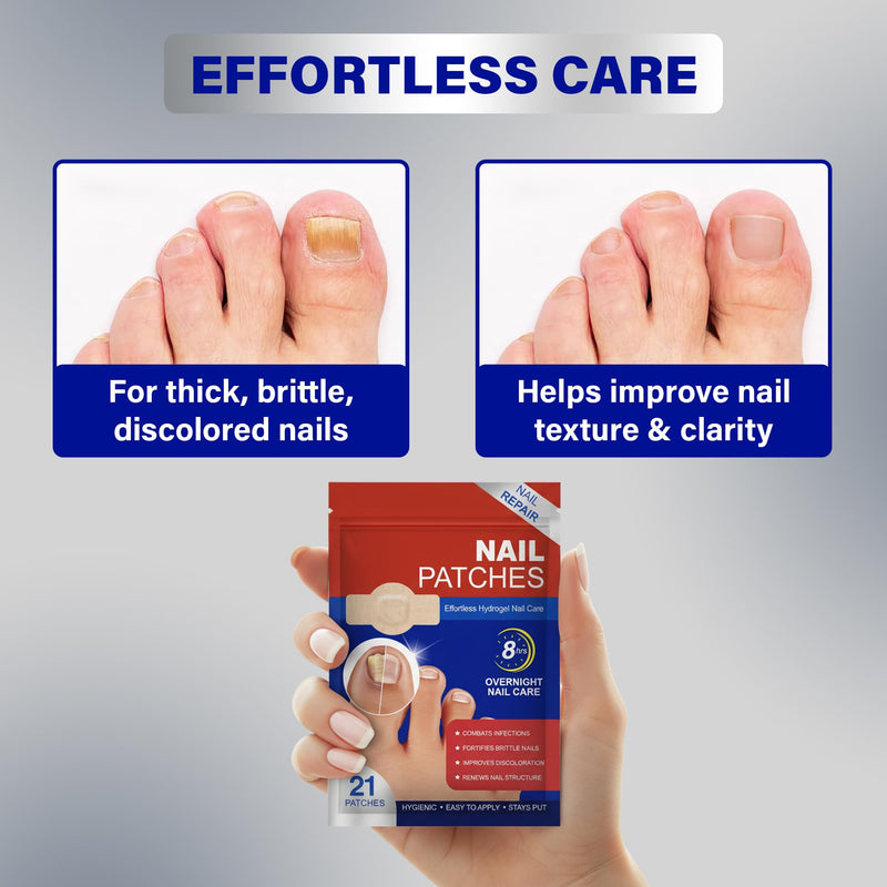 Fungal Nail Patches – 8-Hour Overnight Toenail Support for Nail Damage| Nighttime Repair Stickers 4 Pack (84 Paches)