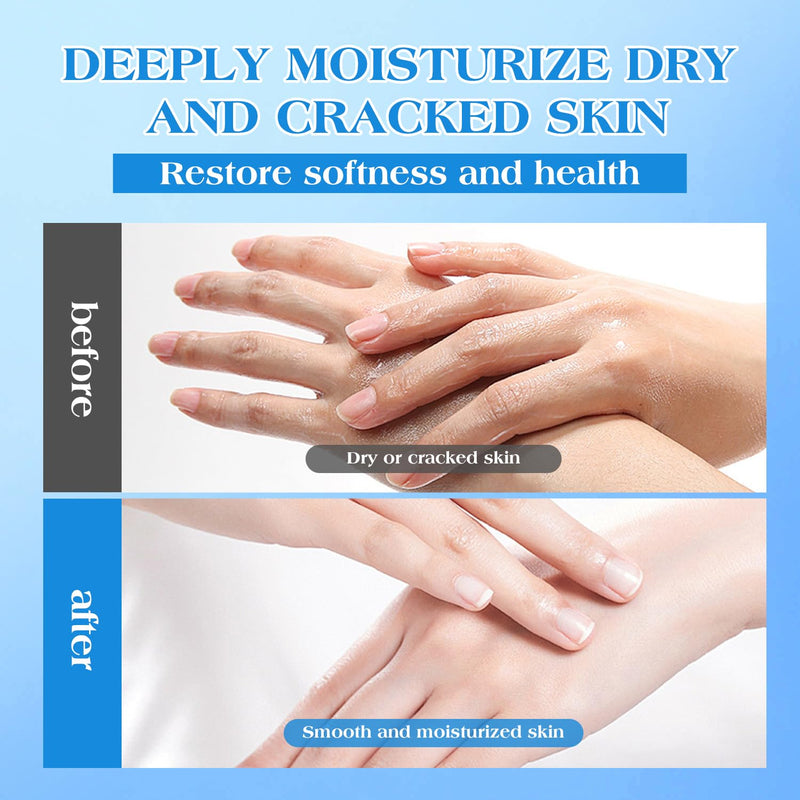 42% Urea Cream for Dry & Cracked Skin - Foot & Hand Cream with 2% Salicylic Acid, 5% Vitamin E, Tea Tree Oil, Aloe Vera, Shea Butter - Moisturizer & Skin Repair Cream for Feet Maximum Strength - BeesActive Australia