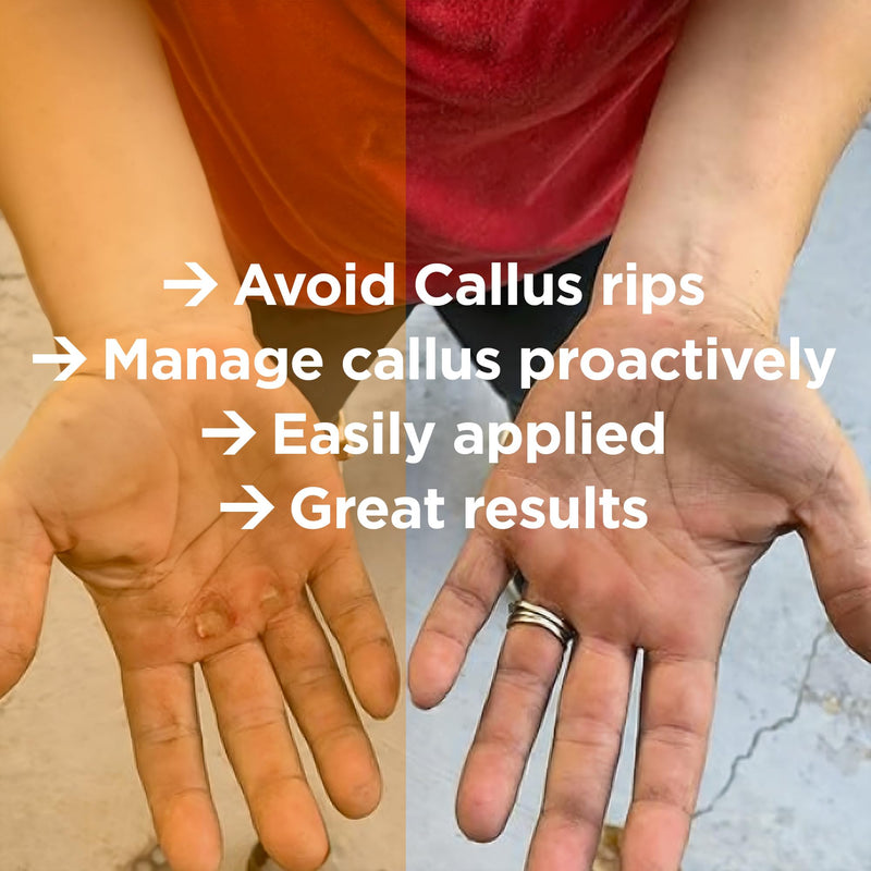 Callus Score & 2 Smoothers – Ultimate Precision Hand Callus Remover | Prevents Ripping | Smoother for Athletes, Weightlifters & Gym Enthusiasts | Solution for Dry, Rough Hands & Fingers Score Bundle with Additional Smoothing caps - BeesActive Australia